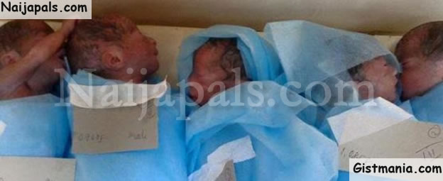 Women Gives Birth To Sextuplets 60